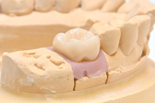 横浜市泉区の歯科でオールセラミックなら、いずみ中央駅前歯科